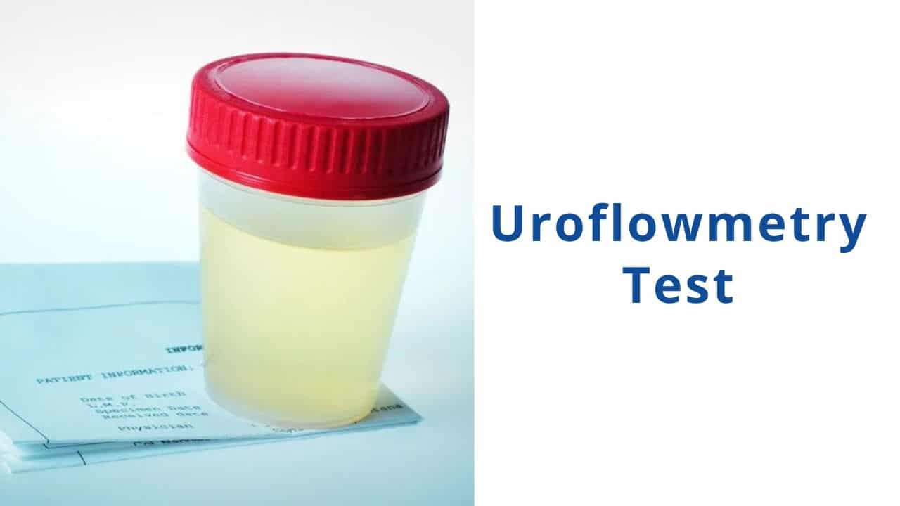 Uroflowmentry Test in Vaishali,Indirapuram 